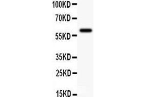 Anti-KCNN antibody,  Western blotting All lanes: Anti KCNN() at 0. (KCNN4 Antikörper  (N-Term))