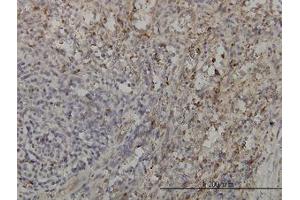 Image no. 2 for anti-GRB2-Related Adaptor Protein 2 (GRAP2) (AA 226-316) antibody (ABIN599077) (GRAP2 Antikörper  (AA 226-316))