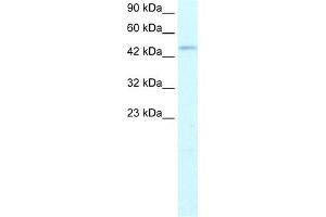WB Suggested Anti-TFDP2 Antibody Titration:  1. (DP2 Antikörper  (N-Term))