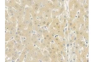 ABIN6258653 and ABIN6275645 at 1/100 staining human normal liver tissue by IHC-P.