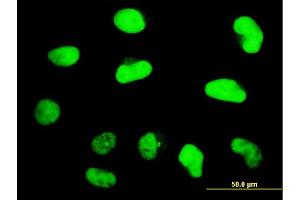 Immunofluorescence of monoclonal antibody to ZNF207 on HeLa cell. (ZNF207 Antikörper  (AA 1-110))