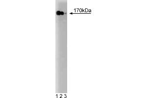 Western Blotting (WB) image for anti-PI3-Kinase p170 antibody (ABIN968340) (PI3-Kinase p170 Antikörper)