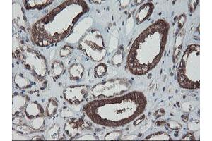 Image no. 12 for anti-SKI-Like Oncogene (SKIL) (AA 307-684) antibody (ABIN1491380) (SKIL Antikörper  (AA 307-684))