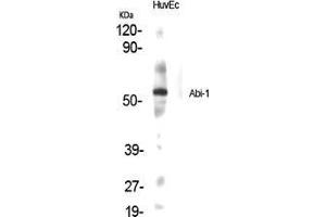 Western Blot (WB) analysis of specific cells using Abi-1 Polyclonal Antibody. (ABI1 Antikörper  (Internal Region))