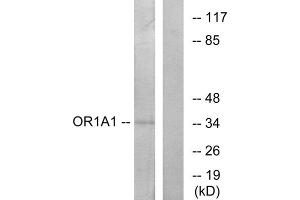 Western blot analysis of extracts from COLO cells, using OR1A1 antibody. (OR1A1 Antikörper  (C-Term))