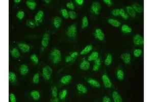 IF analysis of CTBP1 using anti-CTBP1 antibody (ABIN3043816). (CTBP1 Antikörper  (C-Term))