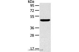 Western blot analysis of Mouse liver tissue, using TM7SF2 Polyclonal Antibody at dilution of 1:400 (TM7SF2 Antikörper)