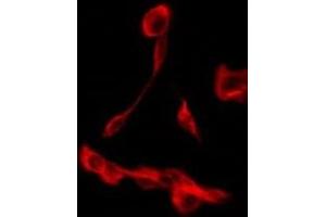 ABIN6275268 staining JK by IF/ICC. (SLC9A3R2 Antikörper  (Internal Region))