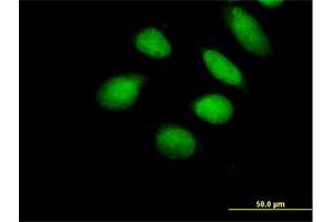 Immunofluorescence of purified MaxPab antibody to SUHW1 on HeLa cell. (ZNF280A Antikörper  (AA 1-542))