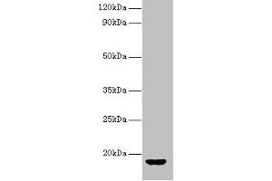 Western blot All lanes: AVP antibody at 2 μg/mL + Rat gonadal tissue Secondary Goat polyclonal to rabbit IgG at 1/10000 dilution Predicted band size: 18 kDa Observed band size: 18 kDa (Vasopressin Antikörper  (AA 126-164))
