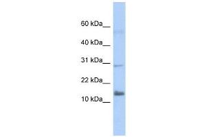FAM14A antibody used at 1 ug/ml to detect target protein. (IFI27L2 Antikörper  (Middle Region))