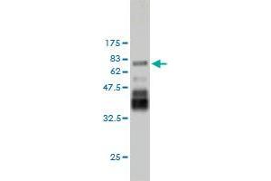 Western Blotting (WB) image for anti-PDZ and LIM Domain 7 (Enigma) (PDLIM7) (AA 1-457) antibody (ABIN563997)