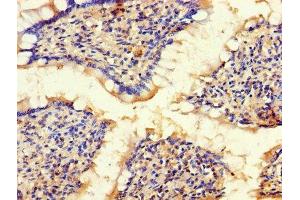 Immunohistochemistry of paraffin-embedded human small intestine tissue using ABIN7145600 at dilution of 1:100 (BLOC1S1 Antikörper  (AA 1-153))
