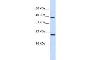 WB Suggested Anti-CHRAC1 Antibody Titration:  0. (CHRAC1 Antikörper  (N-Term))
