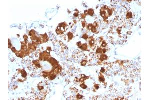 Formalin-fixed, paraffin-embedded human Pituitary stained with ACTH Mouse Monoclonal Antibody (CLIP/1407).