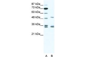 WB Suggested Anti-ZNF488 Antibody Titration:  1. (ZNF488 Antikörper  (C-Term))
