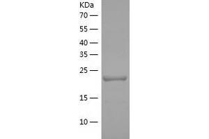 Western Blotting (WB) image for Proteasome (Prosome, Macropain) Activator Subunit 2 (PA28 Beta) (PSME2) (AA 2-239) protein (His tag) (ABIN7289369) (PSME2 Protein (AA 2-239) (His tag))