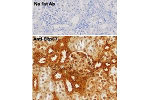 Immunohistochemistry (IHC) image for anti-Protein Disulfide Isomerase Family A, Member 3 (PDIA3) (C-Term) antibody (ABIN1440038) (PDIA3 Antikörper  (C-Term))