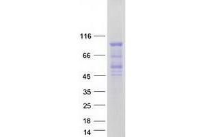 Validation with Western Blot (FOXP4 Protein (Transcript Variant 1) (Myc-DYKDDDDK Tag))