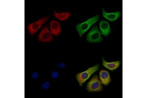 CD1a Antibody staining Hela cells by IF/ICC. (CD1a Antikörper  (N-Term))