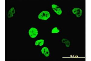 Immunofluorescence of monoclonal antibody to TCF7L2 on HeLa cell. (TCF7L2 Antikörper  (AA 490-596))
