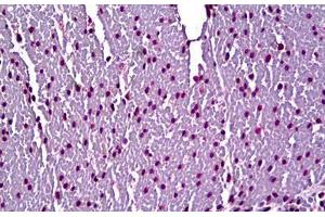 Anti-Myosin, Cardiac Heavy Chain antibody IHC staining of human heart.