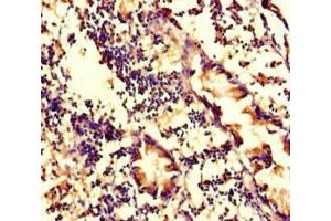 Immunohistochemistry of paraffin-embedded human appendix tissue using ABIN7175714 at dilution of 1:100