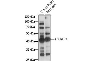 Western blot analysis of extracts of various cell lines, using  antibody (ABIN7265500) at 1:1000 dilution. (ADPRHL1 Antikörper  (AA 80-280))