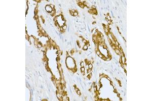 Immunohistochemistry (IHC) image for anti-Acid Phosphatase, Prostate (ACPP) (AA 40-300) antibody (ABIN3022672)