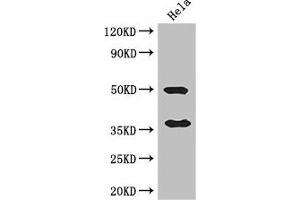 Western Blot Positive WB detected in: Hela whole cell lysate All lanes: AKR1B1 antibody at 3 μg/mL Secondary Goat polyclonal to rabbit IgG at 1/50000 dilution Predicted band size: 36 kDa Observed band size: 36, 50 kDa (AKR1B1 Antikörper  (AA 114-230))