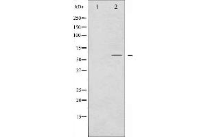 Western blot analysis of Smad3 phosphorylation expression in NIH-3T3 whole cell lysates,The lane on the left is treated with the antigen-specific peptide.