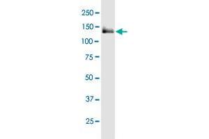 Western Blotting (WB) image for anti-Euchromatic Histone-Lysine N-Methyltransferase 1 (EHMT1) (AA 1-100) antibody (ABIN529068)
