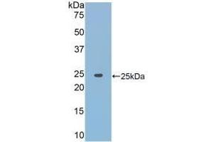 Detection of Recombinant JAK2, Rat using Polyclonal Antibody to Janus Kinase 2 (JAK2) (JAK2 Antikörper  (AA 916-1103))