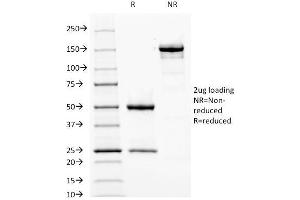 SDS-PAGE (SDS) image for anti-Fascin (FSCN1) antibody (ABIN6940607)