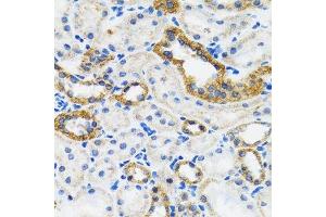 Immunohistochemistry (Paraffin-embedded Sections) (IHC (p)) image for anti-conserved Helix-Loop-Helix Ubiquitous Kinase (CHUK) (C-Term) antibody (ABIN3022825)