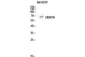 Western Blot (WB) analysis of SH-SY5Y lysis using CRSP70 antibody. (MED26 Antikörper  (N-Term))