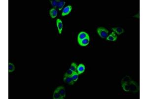Immunofluorescence staining of PC-3 cells with ABIN7160318 at 1:133, counter-stained with DAPI. (ABCC5 Antikörper  (AA 455-566))