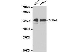 Western Blotting (WB) image for anti-Superkiller Viralicidic Activity 2-Like 2 (SKIV2L2) antibody (ABIN1876780) (MTR4 Antikörper)