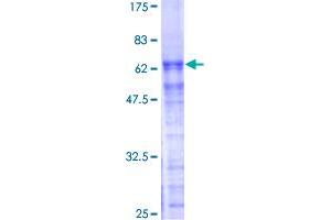 PRPF40A Protein (AA 1-215) (GST tag)