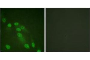 Immunofluorescence analysis of HeLa cells, using NF-kappaB p65 (Ab-310) Antibody.