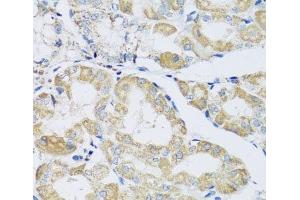 Immunohistochemistry of paraffin-embedded Human stomach using ATPIF1 Polyclonal Antibody at dilution of 1:100 (40x lens). (ATPase Inhibitory Factor 1 Antikörper)