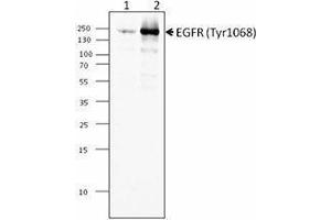 Western Blotting (WB) image for anti-Epidermal Growth Factor Receptor (EGFR) (pTyr1068) antibody (ABIN2666246) (EGFR Antikörper  (pTyr1068))