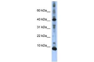 LSM6 antibody used at 1 ug/ml to detect target protein. (LSM6 Antikörper)