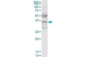 Immunoprecipitation of CCND1 transfected lysate using rabbit polyclonal anti-CCND1 and Protein A Magnetic Bead