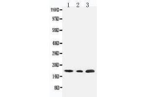 Anti-SDHC antibody, Western blotting Lane 1: Rat Liver Tissue Lysate Lane 2: HELA Tissue Lysate Lane 3: JURKAT Cell Lysate (SDHC Antikörper  (N-Term))