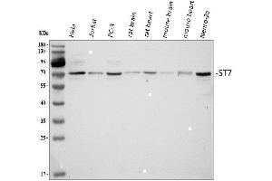 Western blot analysis of ST7 using anti-ST7 antibody (ABIN4886732). (ST7 Antikörper  (Middle Region))