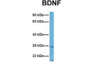 Host:  Rabbit  Target Name:  BDNF  Sample Tissue:  Human ACHN  Antibody Dilution:  1. (BDNF Antikörper  (Middle Region))