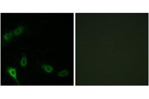 Immunofluorescence analysis of A549 cells, using MARK2 Antibody. (MARK2 Antikörper  (AA 10-59))