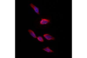 ABIN6261833 and ABIN6273246 staining Hela by IF/ICC.