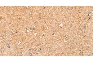Immunohistochemistry of paraffin-embedded Human brain using CCL16 Polyclonal Antibody at dilution of 1:50 (CCL16 Antikörper)